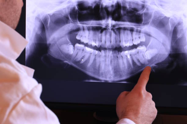 Best Emergency Dental Care for Sports Injuries in Burnt Mills, MD