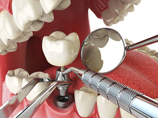 Best 24-Hour Emergency Dental Care in Burnt Mills, MD